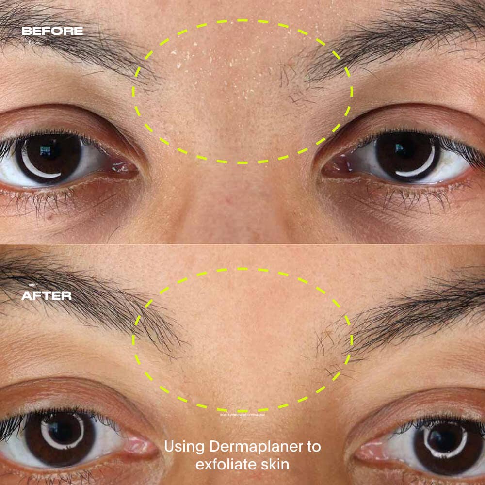 Leaf Dermaplaner Rose Gold